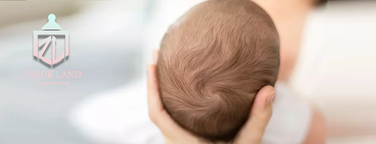 دلایل ریزش موی نوزاد