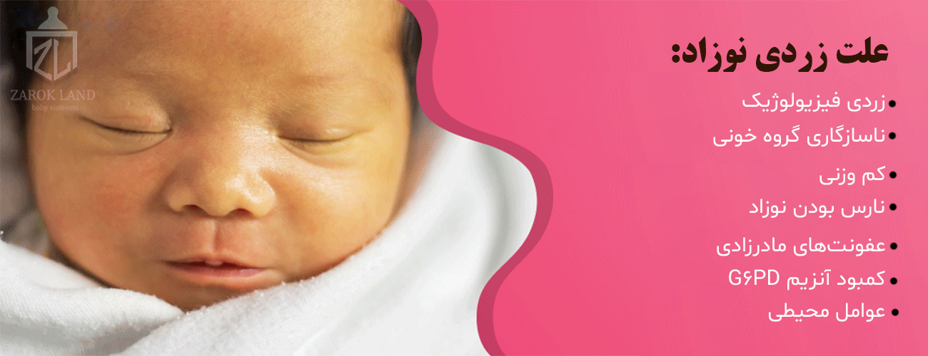علت زردی نوزاد