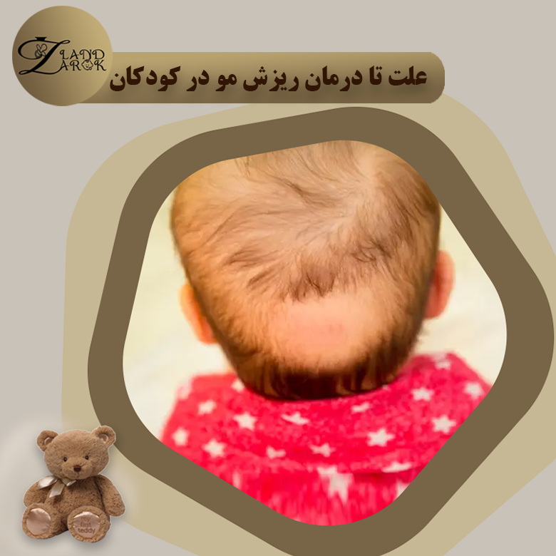 علت و درمان ریزش موی نوزاد