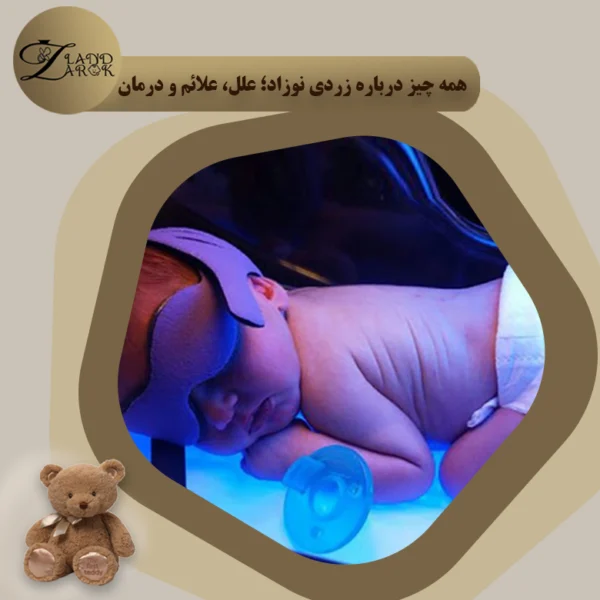 زردی نوزاد چیست؟ علت، علائم+درمان آن