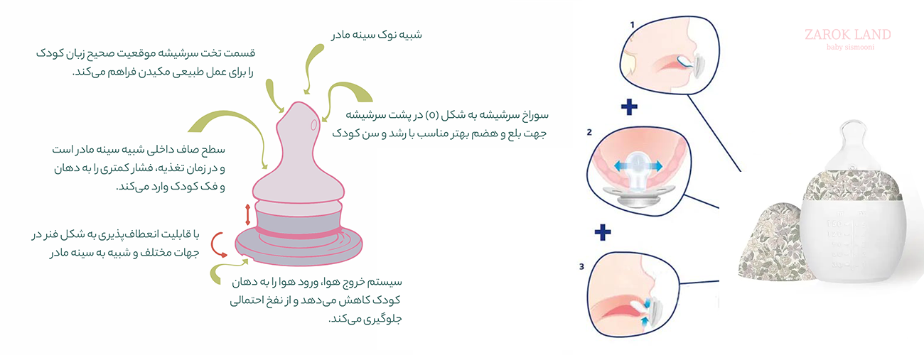 نحوه قرار گرفتن سرشیشه ارتودنسی در دهان نوزاد