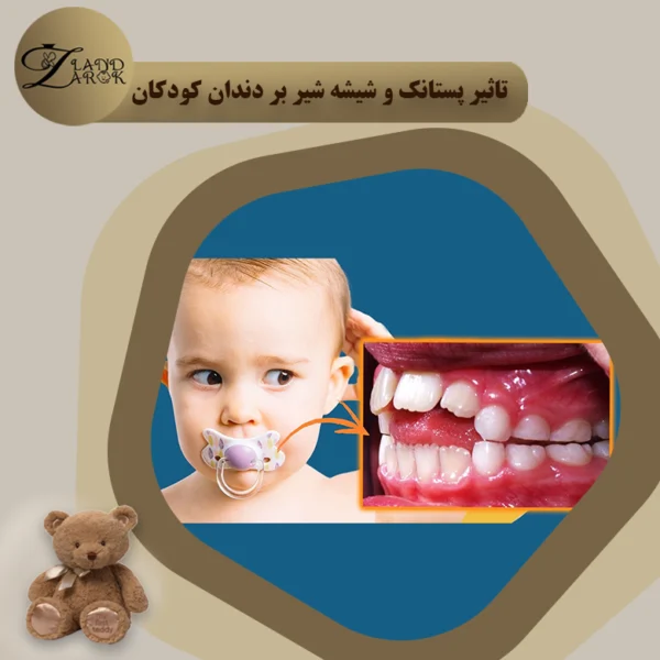 تاثیر پستانک و شیشه شیر بر دندان کودکان