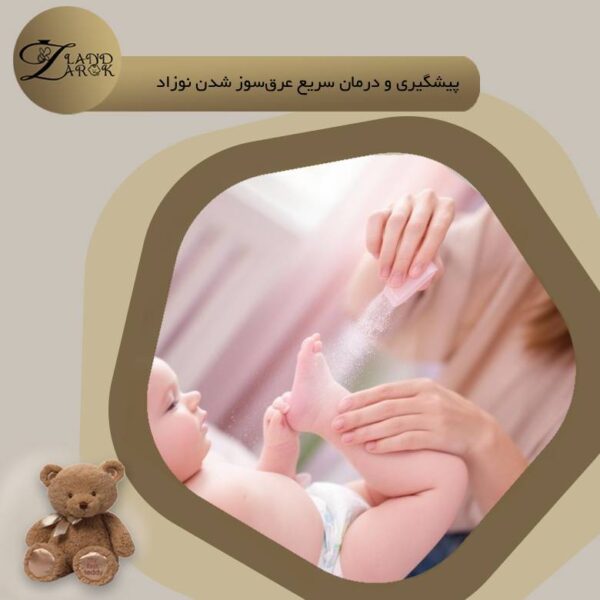 عرق سوز شدن نوزاد